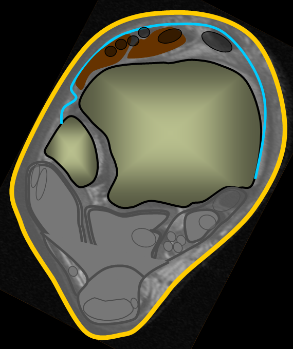 

Anterior tendon and retinaculum

